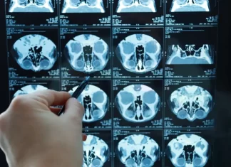 Mutirão de exames zera filas em Sombrio