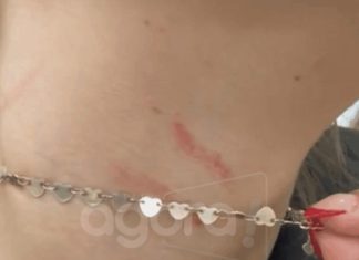 Mãe acusa vigilante de agressão após confusão em escola estadual de Araranguá