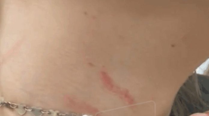Mãe acusa vigilante de agressão após confusão em escola estadual de Araranguá