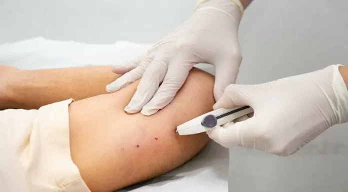 Sombrio amplia opções de planejamento reprodutivo com oferta de implante contraceptivo